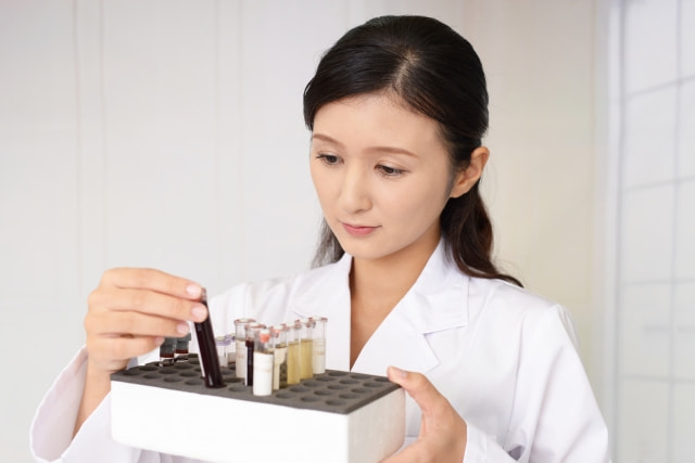 卵巣がんの検査画像